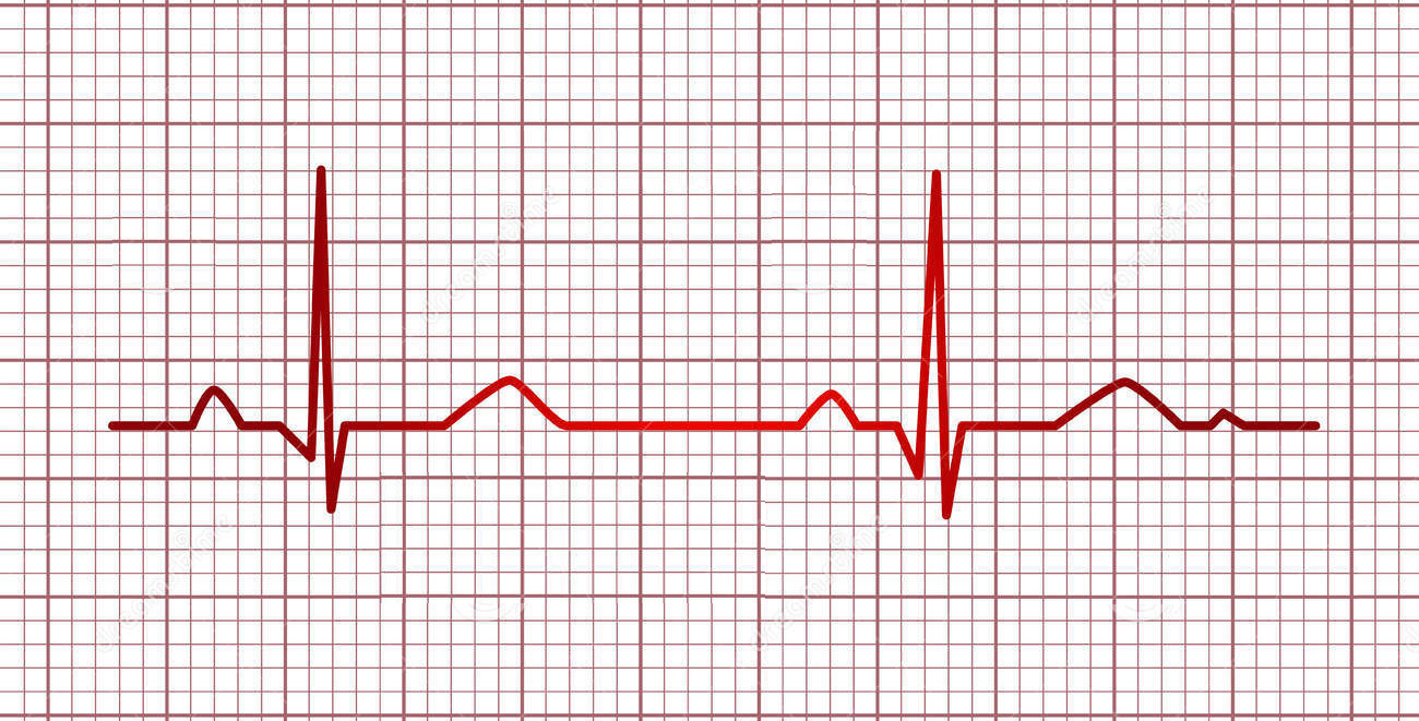 El Electrocardiograma Medicina Preventiva Santa Fe